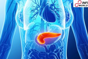 Things you have to think about the connection between diabetes and pancreatic cancer